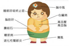 便携式骨密度检测仪检测发现肥胖与许多健康问题有关体重增加使骨质疏松风险